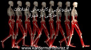 درمان اختلالات حرکتی در شیراز /فیزیوتراپی و کاردرمانی در شیراز /درمان حرکات کودکان و بزرگسالان