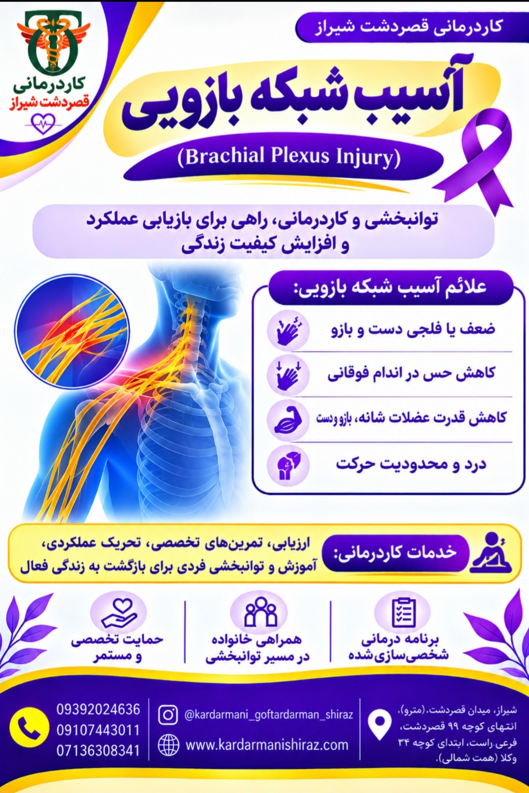 درمان آسیب شبکه بازویی شیراز_فلج ارب و فلج کلامپکه