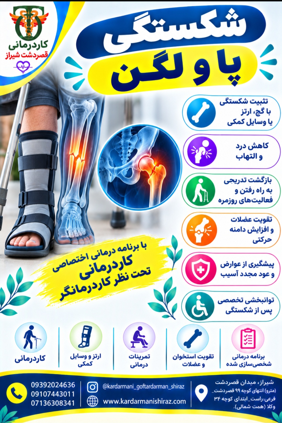 شکستگی پا؛ انواع، درمان و نقش کاردرمانی در بازگشت به راه رفتن طبیعی | کلینیک قصردشت شیراز