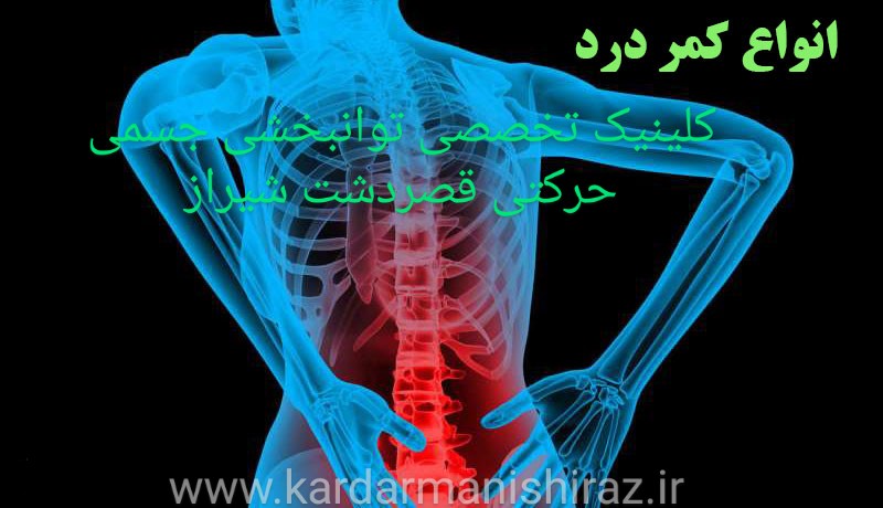 انواع کمردرد و درمان توانبخشی شیراز/کاردرمانی قصردشت