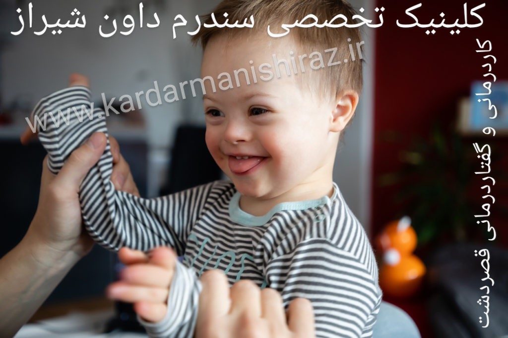 درمان لجبازی کودکان شیراز_گفتاردرمانی سندروم داون