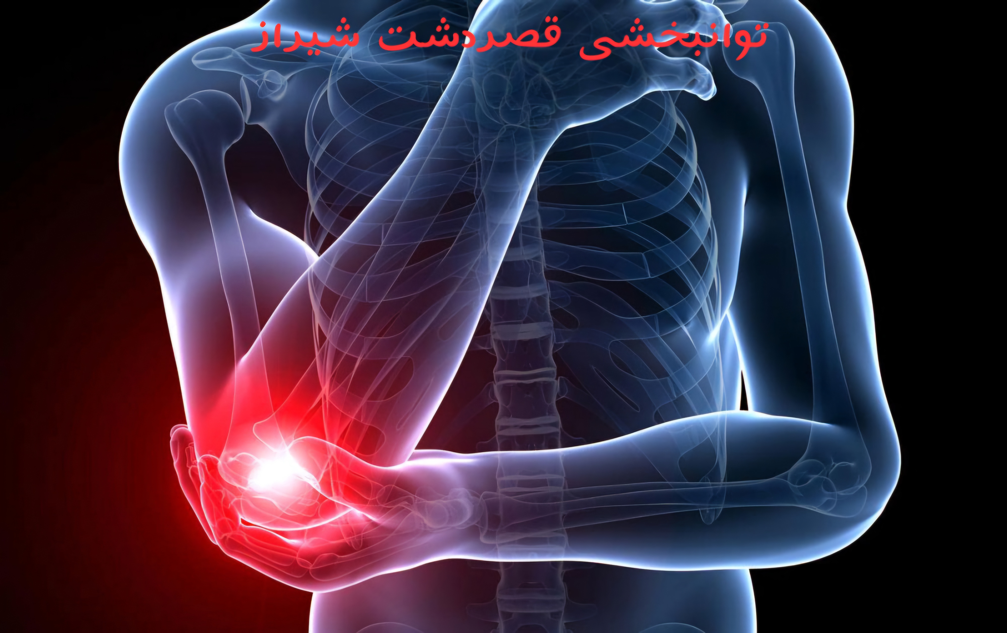 تنیس البو یا اپی کندیلیت خارجی :درد آرنج را برای همیشه مهار کنید !