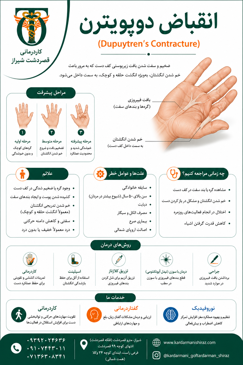 انقباض دوپویترن ؛ علائم، درمان و نقش کاردرمانی  شیراز در بهبود عملکرد دست