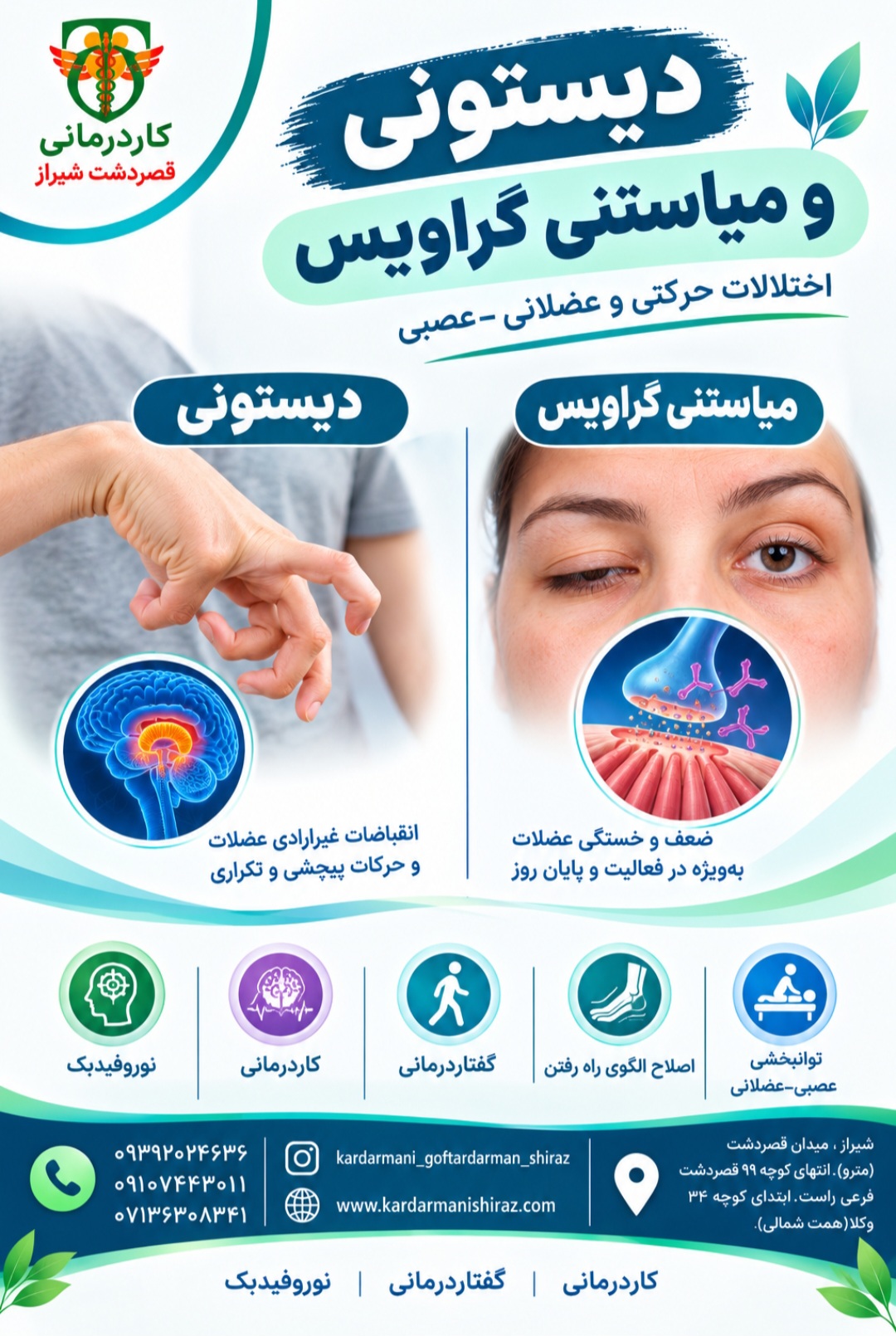 درمان میاستنی گراویس و دیستونی در شیراز؛ نقش کاردرمانی و گفتاردرمانی