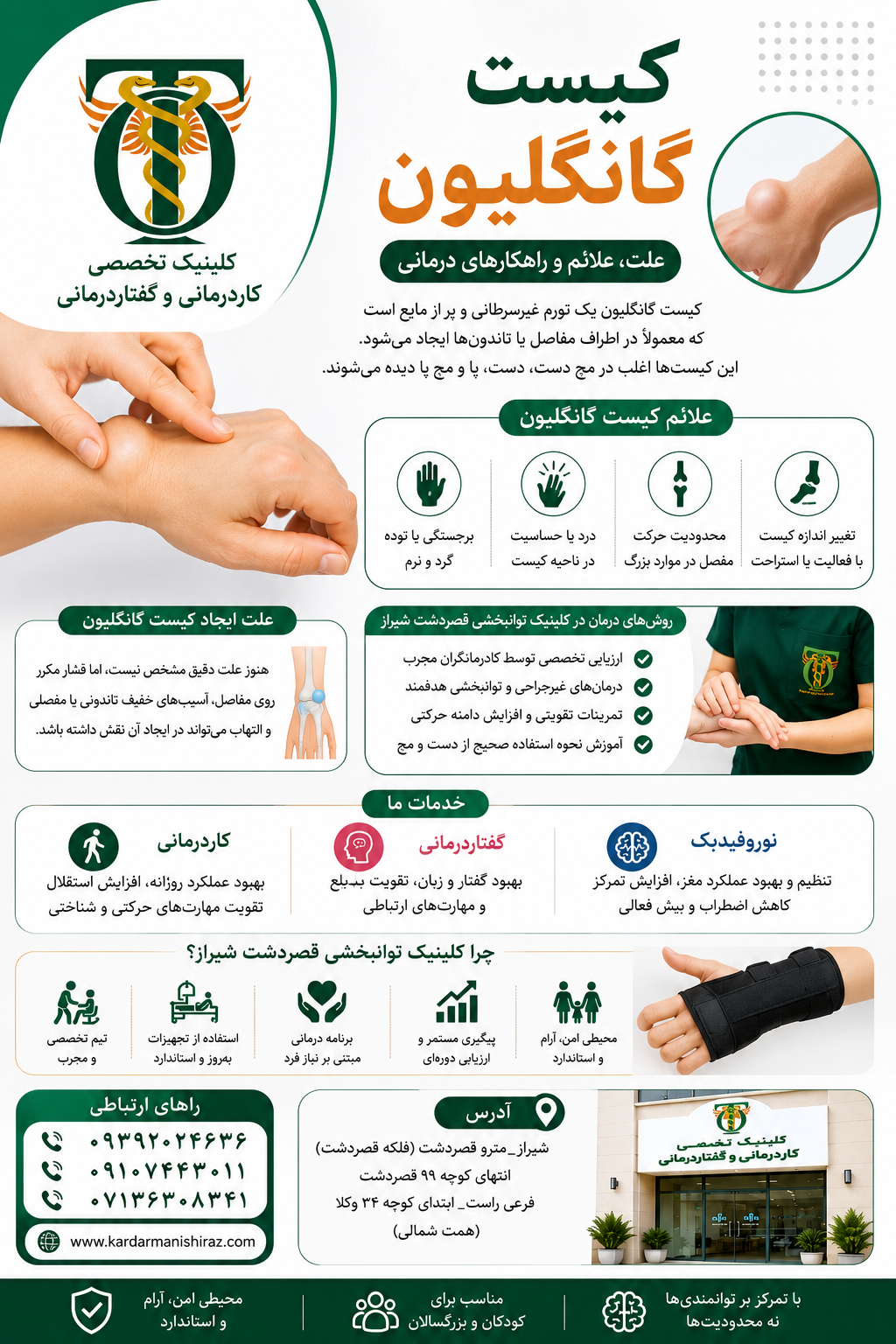 کیست گانگلیون مچ دست و انگشتان؛ علت، تشخیص و نقش کاردرمانی در درمان غیرجراحی شیراز