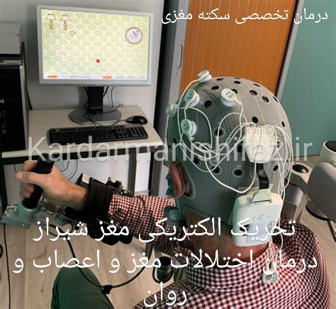 تحریک الکتریکی مغز در درمان سکته مغزی شیراز_تی دی سی اس شیراز