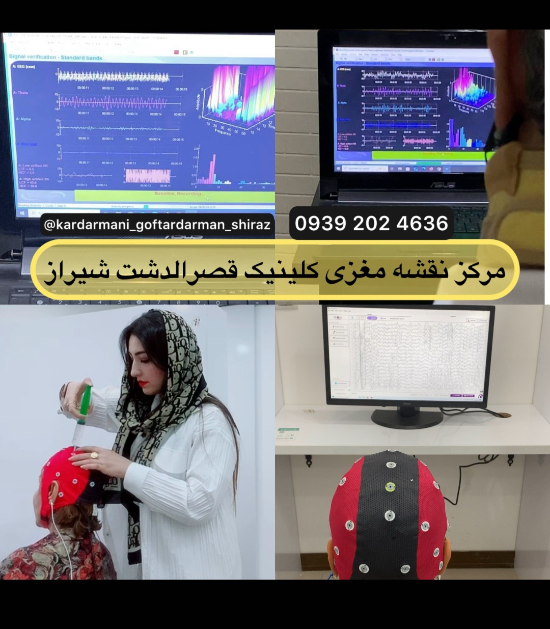 نقشه مغزی (qeeg) در شیراز :کلید طلایی تشخیص و درمان در کلینیک توانبخشی قصردشت