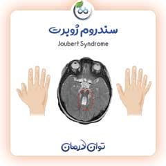 درمان سندرم ژوبرت +کاردرمانی در شیراز