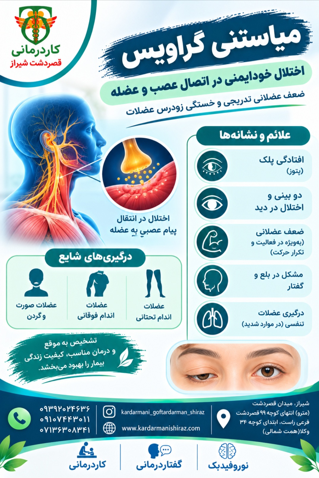 توانبخشی و درمان میاستنی گراویس _کاردرمانی